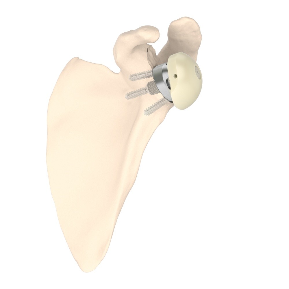Image for 